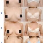 【画像】巨乳のメリットはわかるが貧乳のメリットある